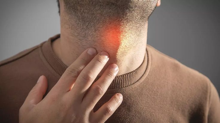 Neck Swelling (Goiter)